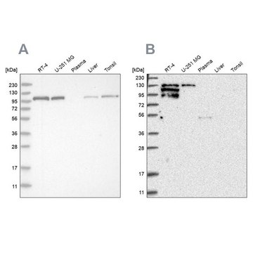 Anti-PTK2B antibody produced in rabbit Prestige Antibodies&#174; Powered by Atlas Antibodies, affinity isolated antibody, buffered aqueous glycerol solution, ab2