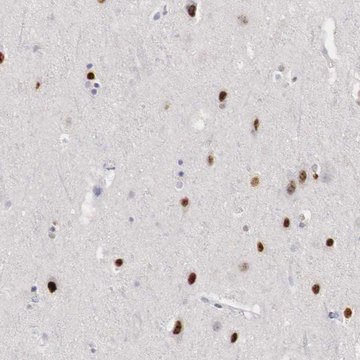 Anti-FOXP2 antibody produced in rabbit AB1, Prestige Antibodies&#174; Powered by Atlas Antibodies, affinity isolated antibody, buffered aqueous glycerol solution