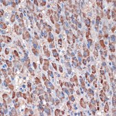 Anti-TIMM50 antibody produced in rabbit