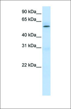 Anti-PRMT3 antibody produced in rabbit affinity isolated antibody