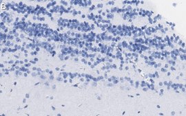 Anti-Doublecortin Antibody, clone 3F11 ZooMAb® Rabbit Monoclonal recombinant, expressed in HEK 293 cells