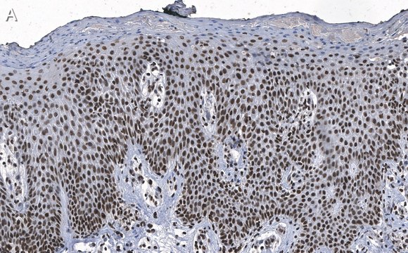 Anti-DNA-RNA hybrid Antibody, clone S9.6 ZooMAb&#174; Mouse Monoclonal recombinant, expressed in HEK 293 cells