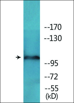 Anti-phospho-NMDAR1 (pSer897) antibody produced in rabbit affinity isolated antibody