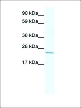 Anti-CRIP2 antibody produced in rabbit affinity isolated antibody