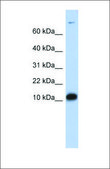 Anti-FABP3 antibody produced in rabbit affinity isolated antibody