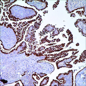 PAX-8 Rabbit Polyclonal Antibody