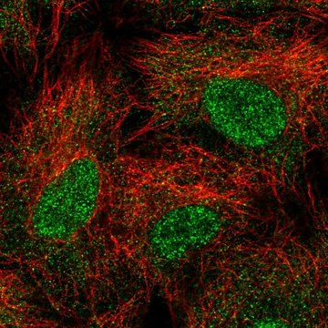 Anti-UBE2B antibody produced in rabbit Prestige Antibodies&#174; Powered by Atlas Antibodies, affinity isolated antibody