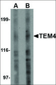 Anti-TEM4 antibody produced in rabbit affinity isolated antibody, buffered aqueous solution