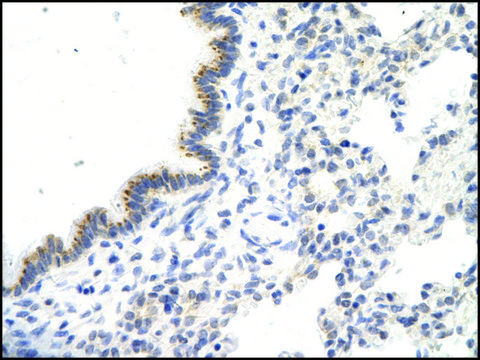 Anti-VDAC3 antibody produced in rabbit affinity isolated antibody