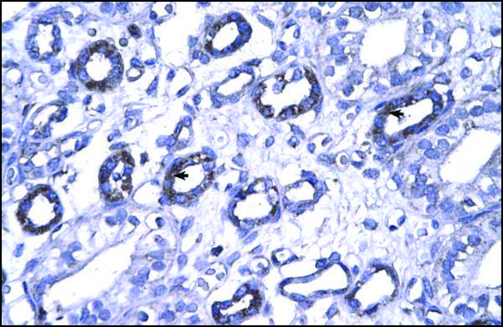 Anti-FOXP1 antibody produced in rabbit IgG fraction of antiserum