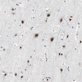 Anti-LIG3 antibody produced in rabbit Prestige Antibodies® Powered by Atlas Antibodies, affinity isolated antibody, buffered aqueous glycerol solution