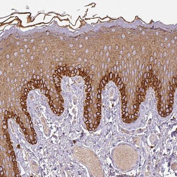 Anti-DAPK1 antibody produced in rabbit Prestige Antibodies&#174; Powered by Atlas Antibodies, affinity isolated antibody, buffered aqueous glycerol solution