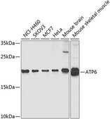 Anti-ATP6 antibody produced in rabbit
