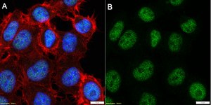 Anti-Nibrin/NBS1 Antibody, clone 3L23 ZooMAb® Rabbit Monoclonal recombinant, expressed in HEK 293 cells