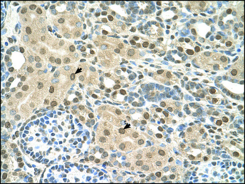 Anti-TMEM30A antibody produced in rabbit affinity isolated antibody