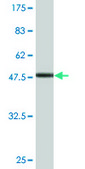 Monoclonal Anti-EXOSC1 antibody produced in mouse clone 2E9, purified immunoglobulin, buffered aqueous solution