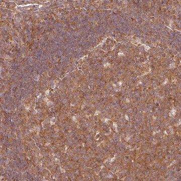 Anti-PDAP1 antibody produced in rabbit Prestige Antibodies&#174; Powered by Atlas Antibodies, affinity isolated antibody, buffered aqueous glycerol solution