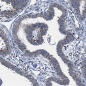 Anti-PDCD1LG2 antibody produced in rabbit Prestige Antibodies® Powered by Atlas Antibodies, affinity isolated antibody, buffered aqueous glycerol solution