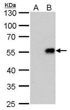 单克隆抗 甲型流感病毒 H1N1 NA（神经氨酸酶） 小鼠抗 clone GT288, affinity isolated antibody