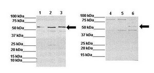 Anti-IL13RA2 (AB1) antibody produced in rabbit affinity isolated antibody