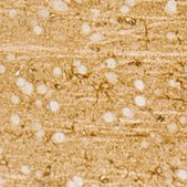 Anti-PI3 Kinase p85 alpha Antibody, clone 7Z9H0, Rabbit Monoclonal