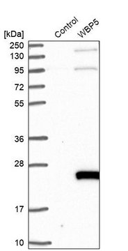 Anti-TCEAL9 antibody produced in rabbit Prestige Antibodies&#174; Powered by Atlas Antibodies, affinity isolated antibody, buffered aqueous glycerol solution