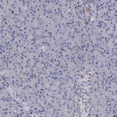 Anti-RHOG antibody produced in rabbit Prestige Antibodies® Powered by Atlas Antibodies, affinity isolated antibody, buffered aqueous glycerol solution