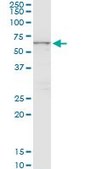 Monoclonal Anti-CTNS antibody produced in mouse clone 5G6, purified immunoglobulin, buffered aqueous solution