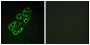 Anti-MTSSB antibody produced in rabbit affinity isolated antibody