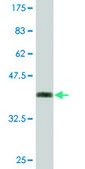 Monoclonal Anti-CBFA2T2 antibody produced in mouse clone 3A2, purified immunoglobulin, buffered aqueous solution