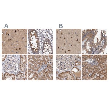 Anti-SCO1 antibody produced in rabbit Prestige Antibodies&#174; Powered by Atlas Antibodies, affinity isolated antibody, buffered aqueous glycerol solution, Ab1