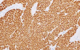 PAX-7 (MRQ-69) Mouse Monoclonal Antibody