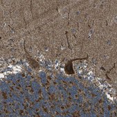 Anti-KLHL5 antibody produced in rabbit Prestige Antibodies® Powered by Atlas Antibodies, affinity isolated antibody, buffered aqueous glycerol solution