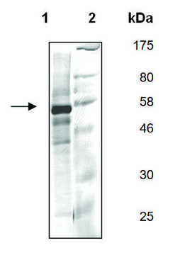 FYN A active human recombinant, expressed in baculovirus infected Sf9 cells, &#8805;60% (SDS-PAGE)