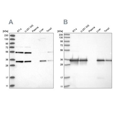 Anti-PPA2 antibody produced in rabbit Prestige Antibodies&#174; Powered by Atlas Antibodies, affinity isolated antibody, buffered aqueous glycerol solution