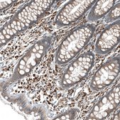 Anti-GADD45G antibody produced in rabbit Prestige Antibodies® Powered by Atlas Antibodies, affinity isolated antibody, buffered aqueous glycerol solution