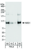 Rabbit anti-NBS1 Antibody, Affinity Purified Powered by Bethyl Laboratories, Inc.
