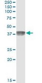 Monoclonal Anti-C4BPB antibody produced in mouse clone 1G9, purified immunoglobulin, buffered aqueous solution