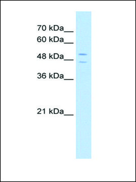 Anti-STEAP3 (AB2) antibody produced in rabbit IgG fraction of antiserum