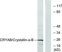 Anti-CRYAB antibody produced in rabbit affinity isolated antibody