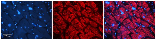 Anti-AKR1B1 antibody produced in rabbit affinity isolated antibody