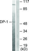 Anti-DP-1, C-Terminal antibody produced in rabbit affinity isolated antibody