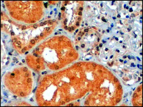 Anti-P70S6K/RPS6KB1 antibody produced in goat affinity isolated antibody, buffered aqueous solution