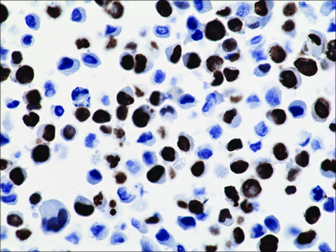 Anti-Histone H3 K36M antibody, Rabbit monoclonal recombinant, expressed in HEK 293 cells, clone RM193, purified immunoglobulin