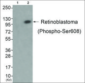 Anti-phospho-Retinoblastoma (pSer608) antibody produced in rabbit affinity isolated antibody