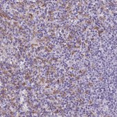 Anti-CD5L antibody produced in rabbit Prestige Antibodies® Powered by Atlas Antibodies, affinity isolated antibody, buffered aqueous glycerol solution