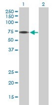 Anti-PINK1 antibody produced in rabbit purified immunoglobulin, buffered aqueous solution