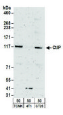 Rabbit anti-CtIP Antibody, Affinity Purified Powered by Bethyl Laboratories, Inc.