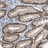 Anti-ERVMER34-1 antibody produced in rabbit Prestige Antibodies® Powered by Atlas Antibodies, affinity isolated antibody, buffered aqueous glycerol solution