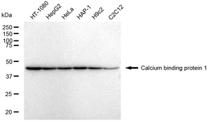 Anti Calcium binding protein 1 Antibody, clone 23GB4365, Rabbit Monoclonal clone 23GB4365, recombinant rabbit monoclonal, expressed in HEK293 cells